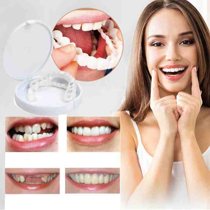 SnapDent™ Snap-On Dentures