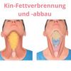 JawDefine™ Say Goodbye to Your Double Chin (Buy 2, Get 1 Free)