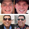 SnapDent™ Snap-On Dentures